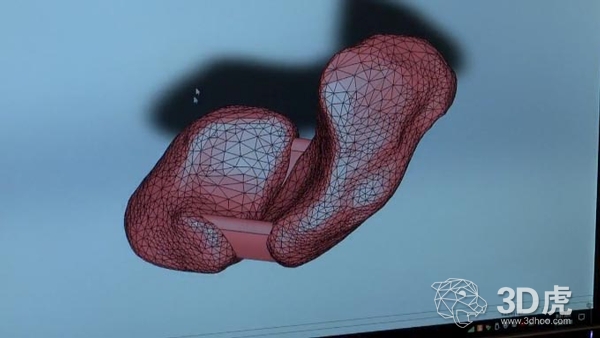 科学家研发出3D打印韧带 或将改变传统治疗方式