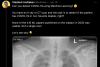 他们翻遍用AI检测新冠的论文，一篇临床可用的也没有？_腾